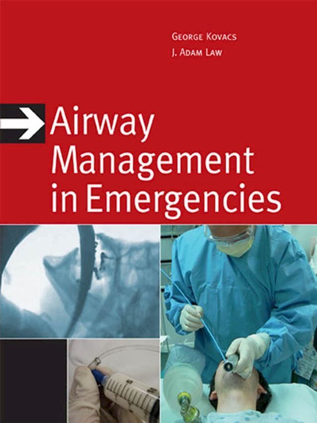  Airway Management in Emergencies(Kobo/電子書)