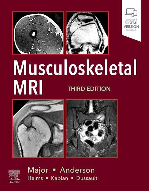 Musculoskeletal MRI(Kobo/電子書)