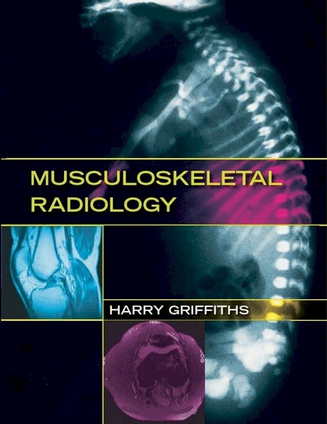  Musculoskeletal Radiology(Kobo/電子書)