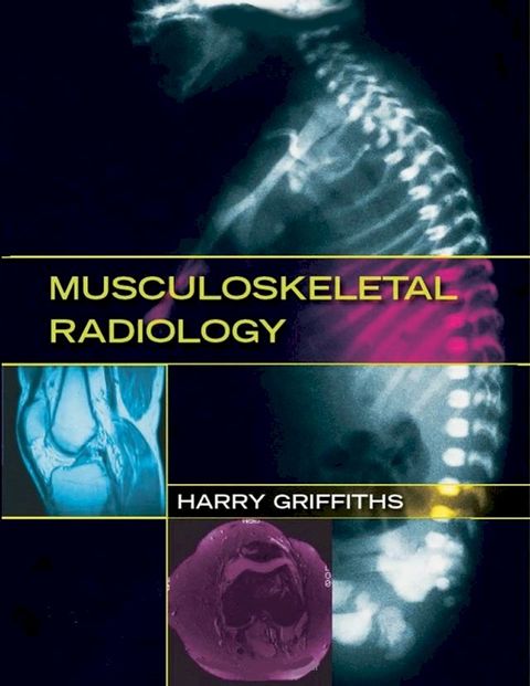 Musculoskeletal Radiology(Kobo/電子書)