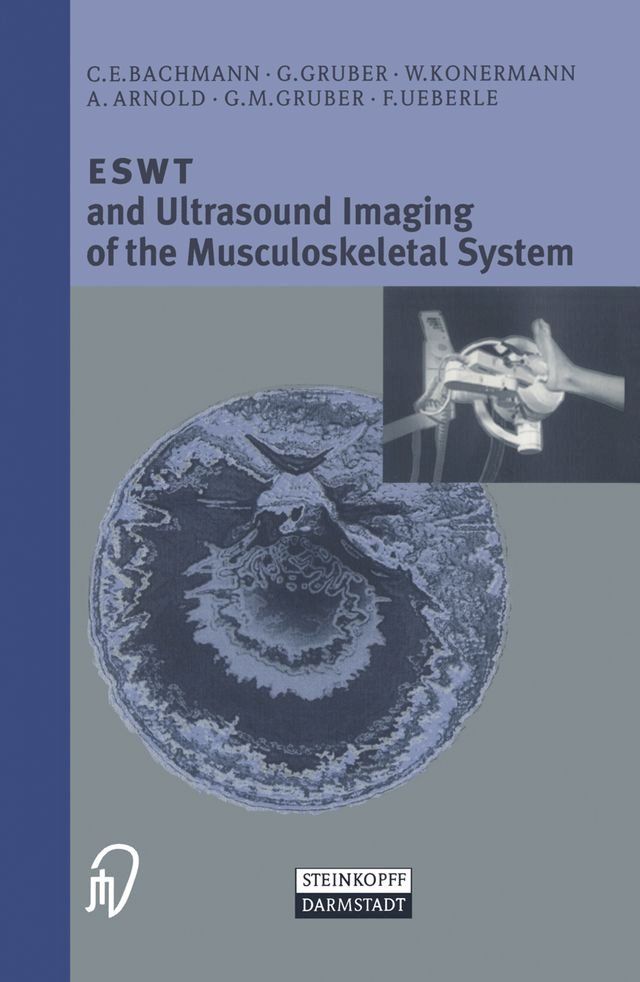  ESWT and Ultrasound Imaging of the Musculoskeletal System(Kobo/電子書)