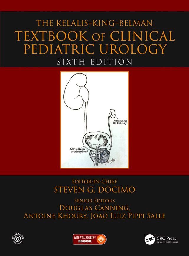  The Kelalis--King--Belman Textbook of Clinical Pediatric Urology(Kobo/電子書)