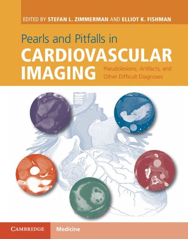  Pearls and Pitfalls in Cardiovascular Imaging(Kobo/電子書)