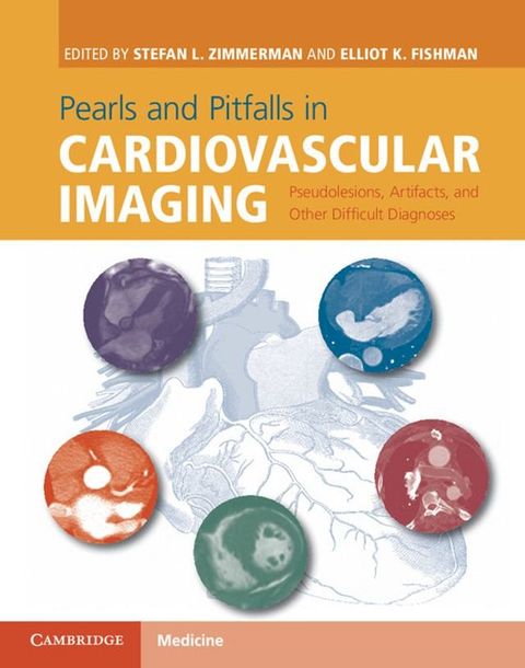 Pearls and Pitfalls in Cardiovascular Imaging(Kobo/電子書)