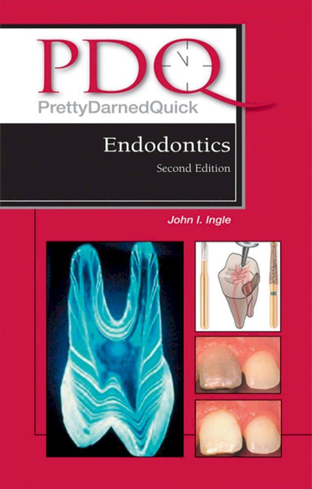  PDQ Endodontics(Kobo/電子書)