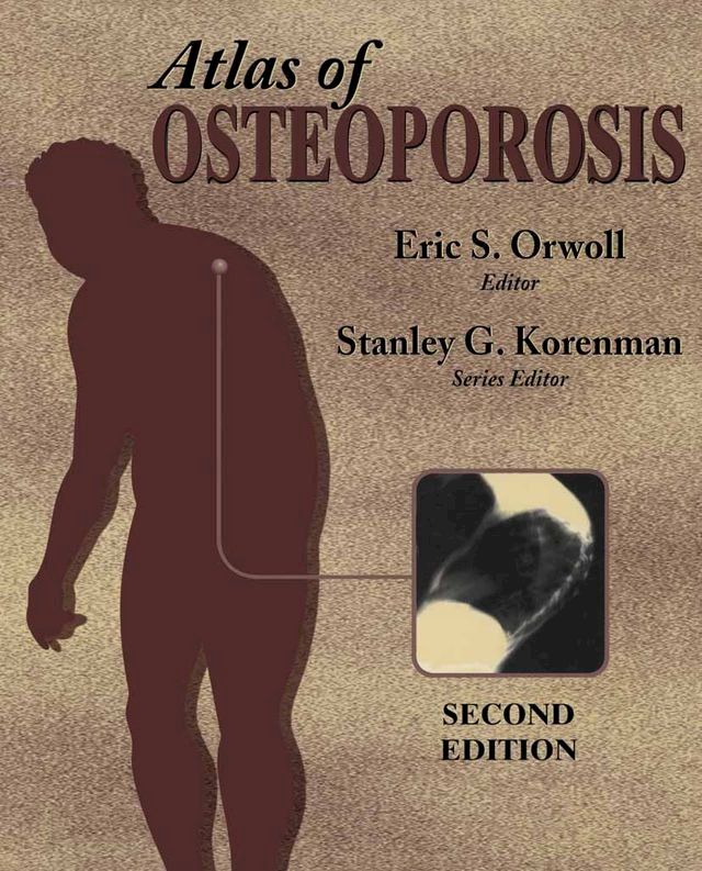  Atlas of Osteoporosis(Kobo/電子書)