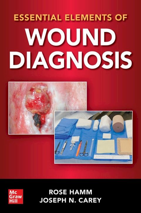 Essential Elements of Wound Diagnosis(Kobo/電子書)