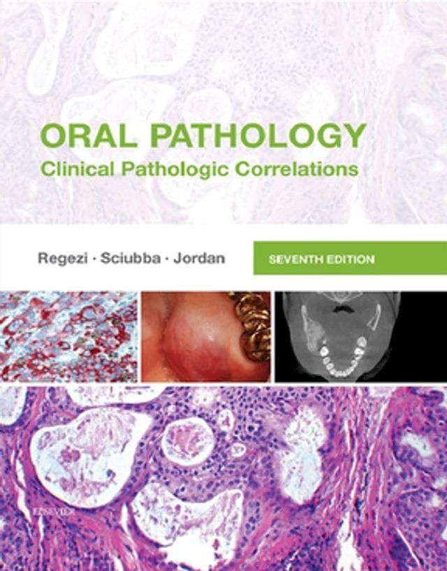  Oral Pathology - E-Book(Kobo/電子書)