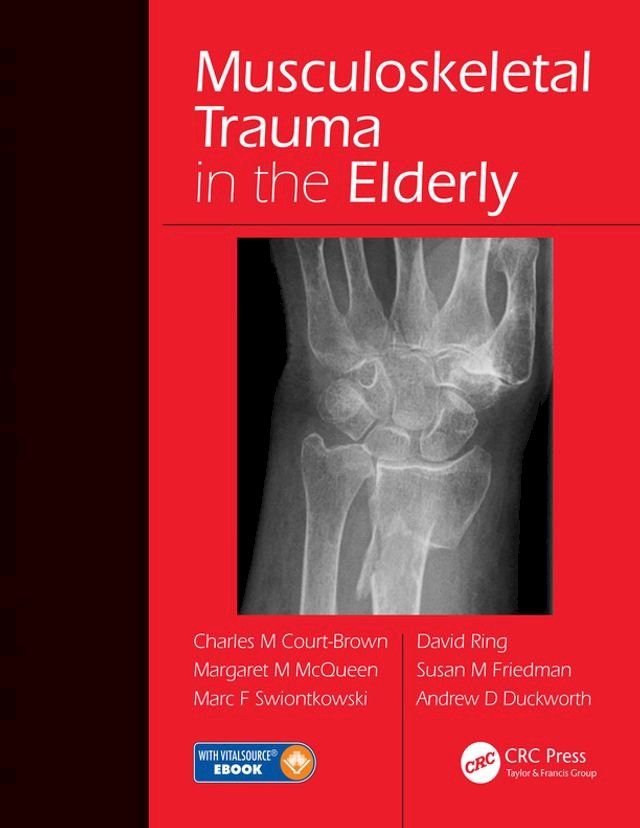  Musculoskeletal Trauma in the Elderly(Kobo/電子書)