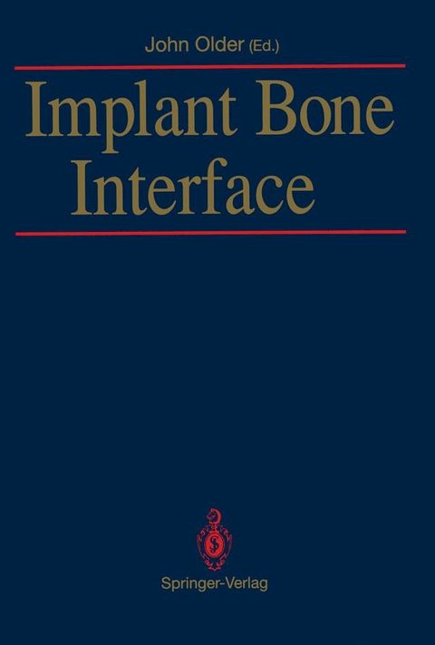 Implant Bone Interface(Kobo/電子書)