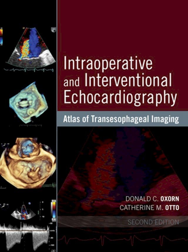  Atlas of Transesophageal Imaging(Kobo/電子書)