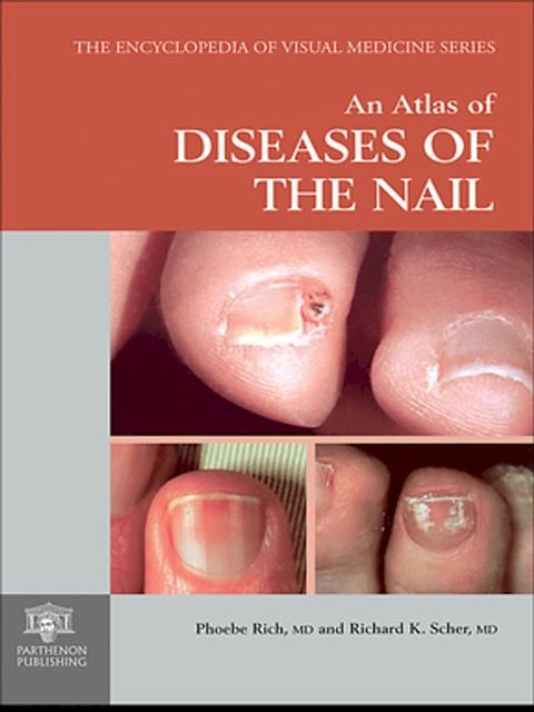 An Atlas of Diseases of the Nail(Kobo/電子書)