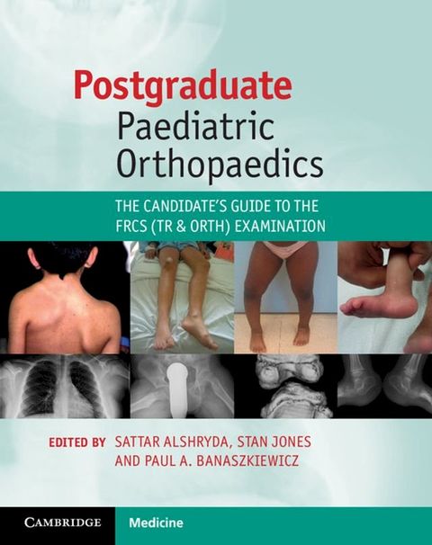 Postgraduate Paediatric Orthopaedics(Kobo/電子書)