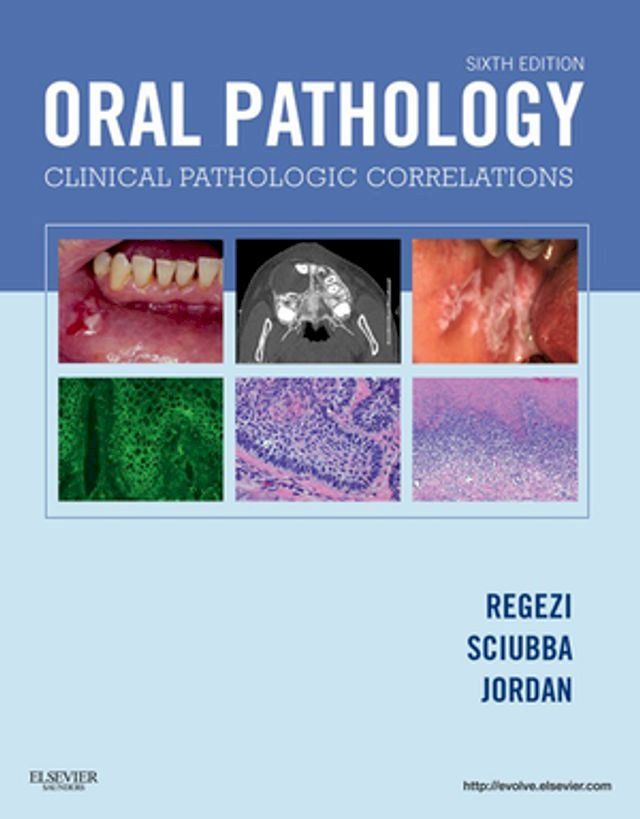  Oral Pathology - E-Book(Kobo/電子書)