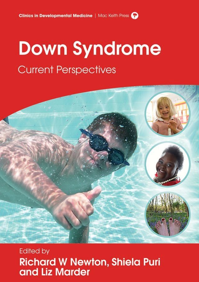  Down Syndrome: Current Perspectives(Kobo/電子書)