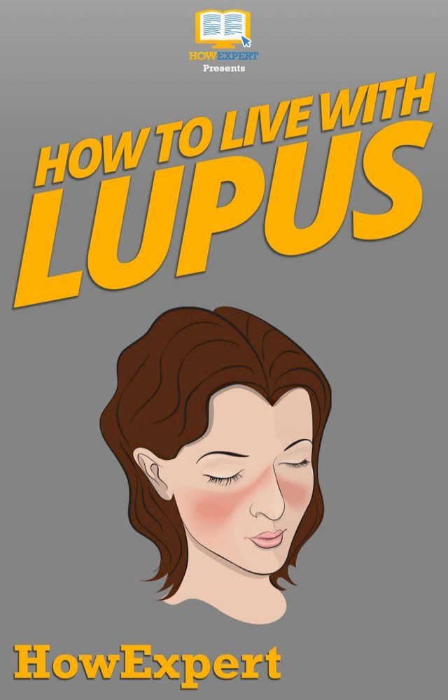  How To Live With Lupus(Kobo/電子書)