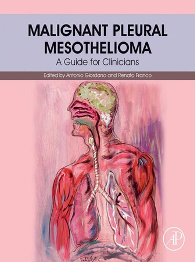  Malignant Pleural Mesothelioma(Kobo/電子書)