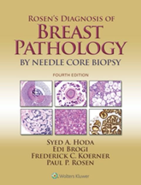 Rosen's Diagnosis of Breast Pathology by Needle Core Biopsy(Kobo/電子書)