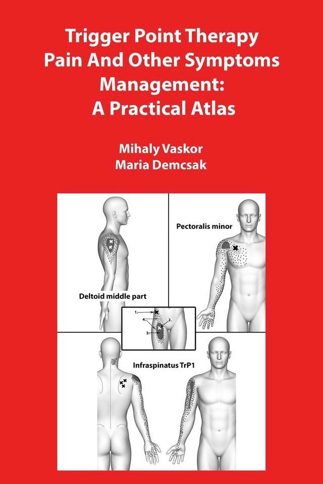  Trigger Point Therapy Pain And Other Symptoms Management: A Practical Atlas(Kobo/電子書)