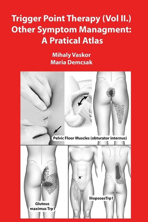 Trigger Point Therapy (Vol II.) Other Symptom Managment: A Pratical Atlas(Kobo/電子書)