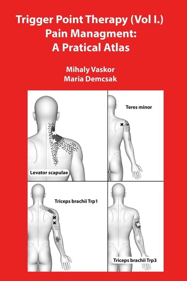  Trigger Point Therapy (Vol I.) Pain Managment: A Pratical Atlas(Kobo/電子書)