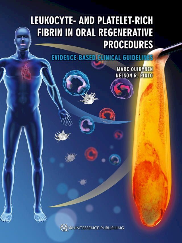  Leukocyte- and Platelet-Rich Fibrin in Oral Regenerative Procedures(Kobo/電子書)