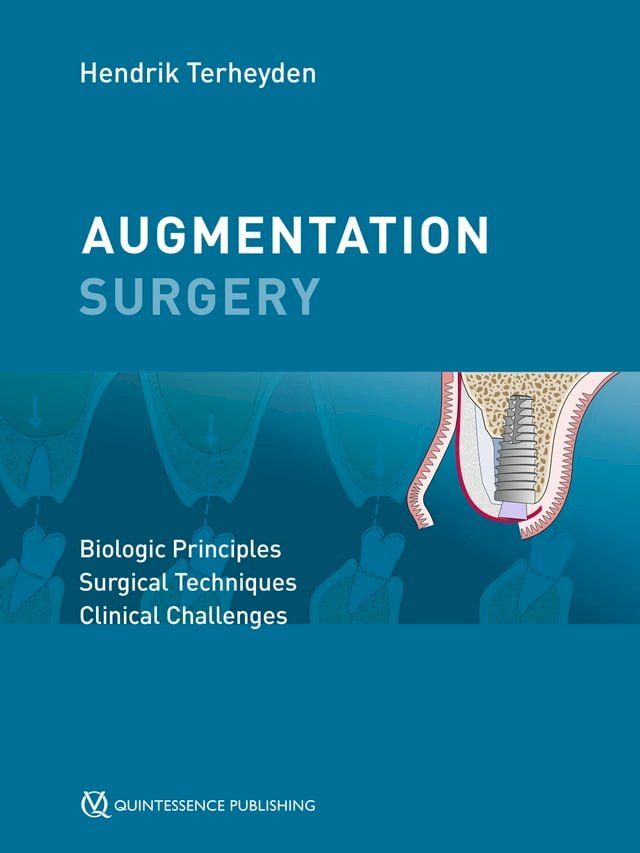  Augmentation Surgery(Kobo/電子書)