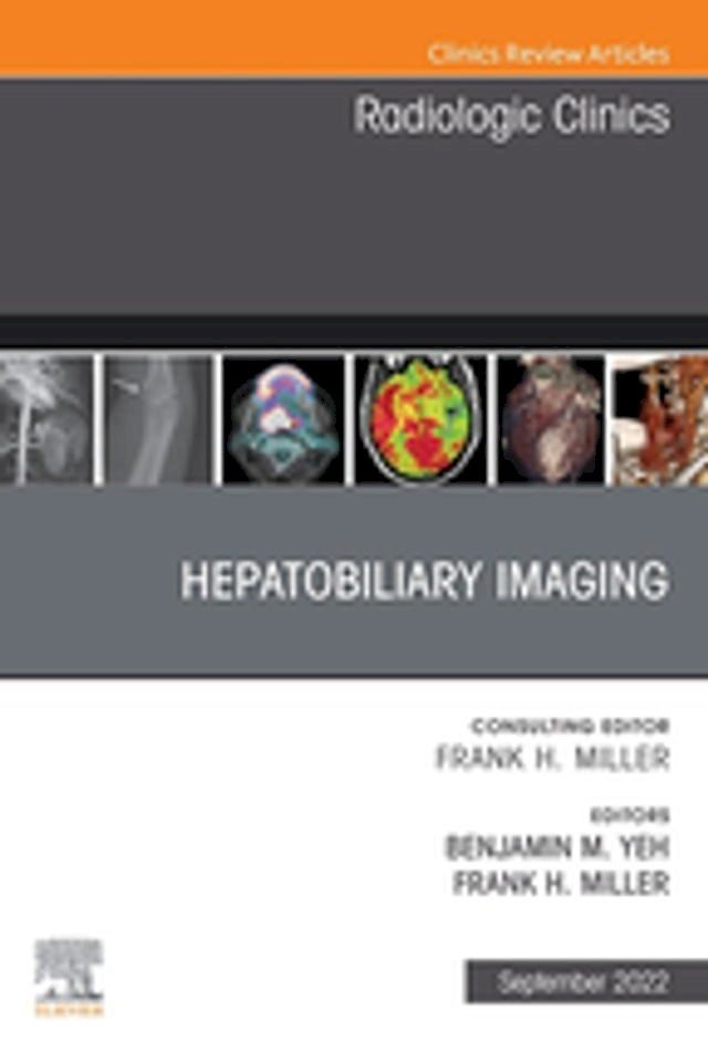  Hepatobiliary Imaging, An Issue of Radiologic Clinics of North America, E-Book(Kobo/電子書)