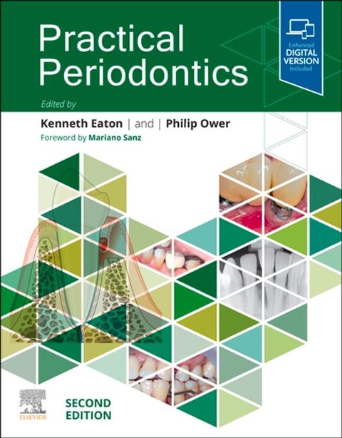 Practical Periodontics - E-Book(Kobo/電子書)