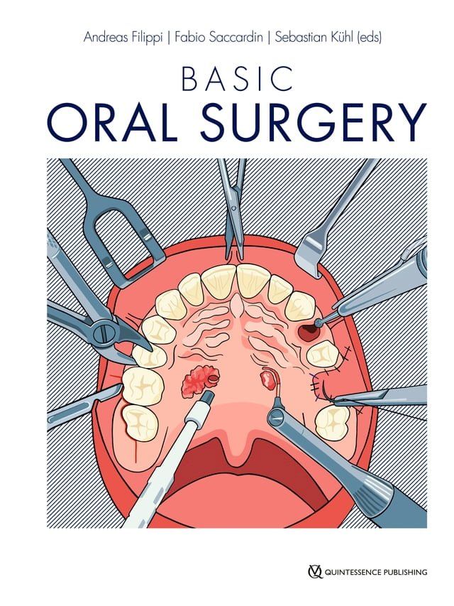  Basic Oral Surgery(Kobo/電子書)