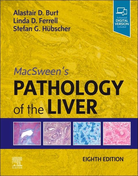 MacSween's Pathology of the Liver(Kobo/電子書)