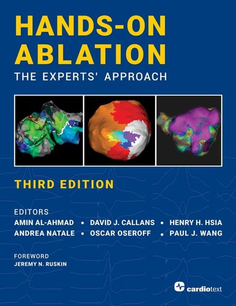 Hands-On Ablation, The Experts' Approach, Third Edition(Kobo/電子書)