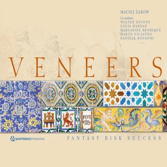  Veneers(Kobo/電子書)