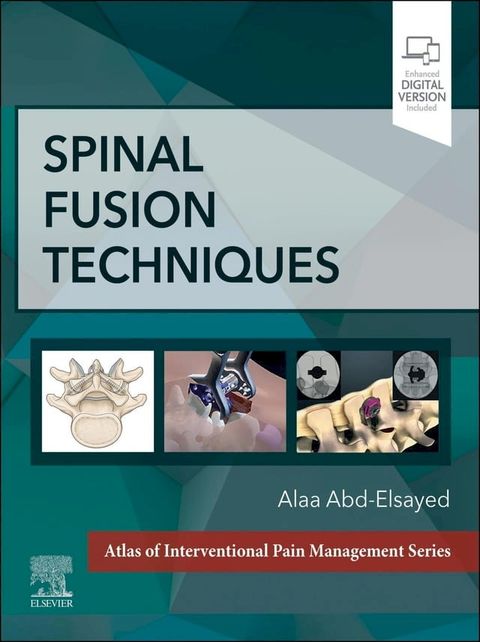 Spinal FusionTechniques(Kobo/電子書)