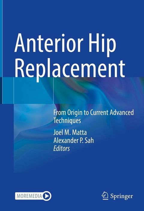 Anterior Hip Replacement(Kobo/電子書)