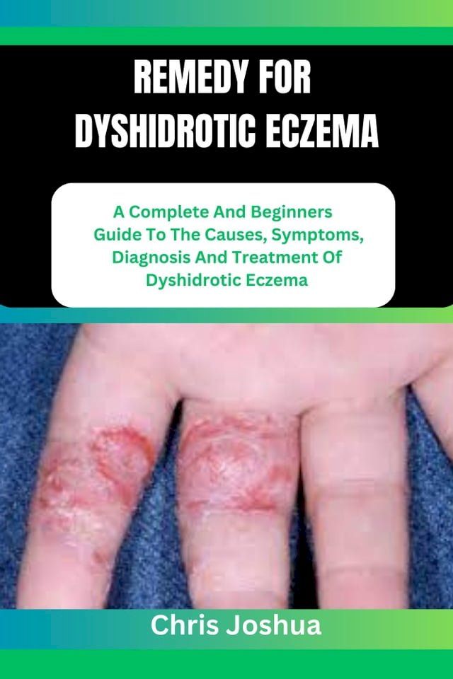  REMEDY FOR DYSHIDROTIC ECZEMA(Kobo/電子書)