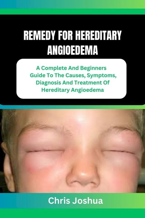 REMEDY FOR HEREDITARY ANGIOEDEMA(Kobo/電子書)