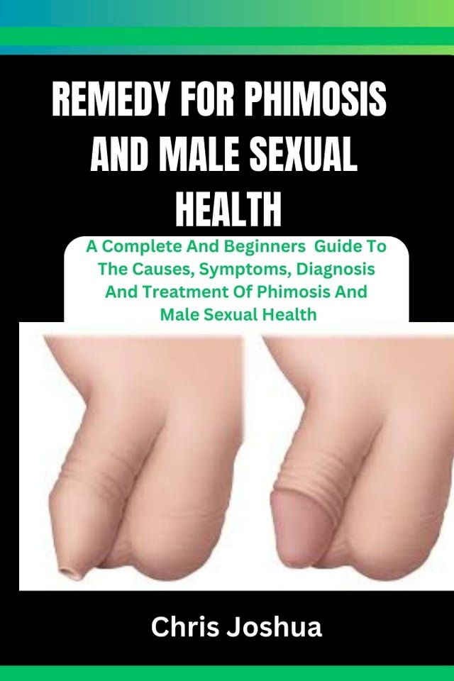  REMEDY FOR PHIMOSIS AND MALE SEXUAL HEALTH(Kobo/電子書)