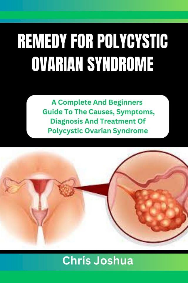  REMEDY FOR POLYCYSTIC OVARIAN SYNDROME(Kobo/電子書)