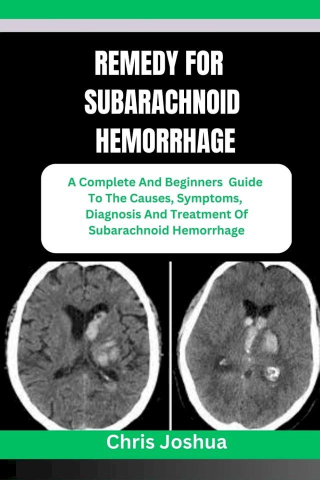  REMEDY FOR SUBARACHNOID HEMORRHAGE(Kobo/電子書)