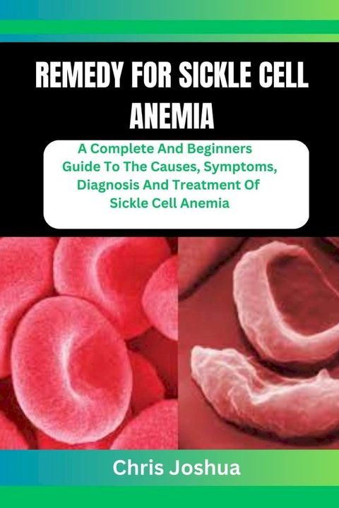 REMEDY FOR SICKLE CELL ANEMIA(Kobo/電子書)