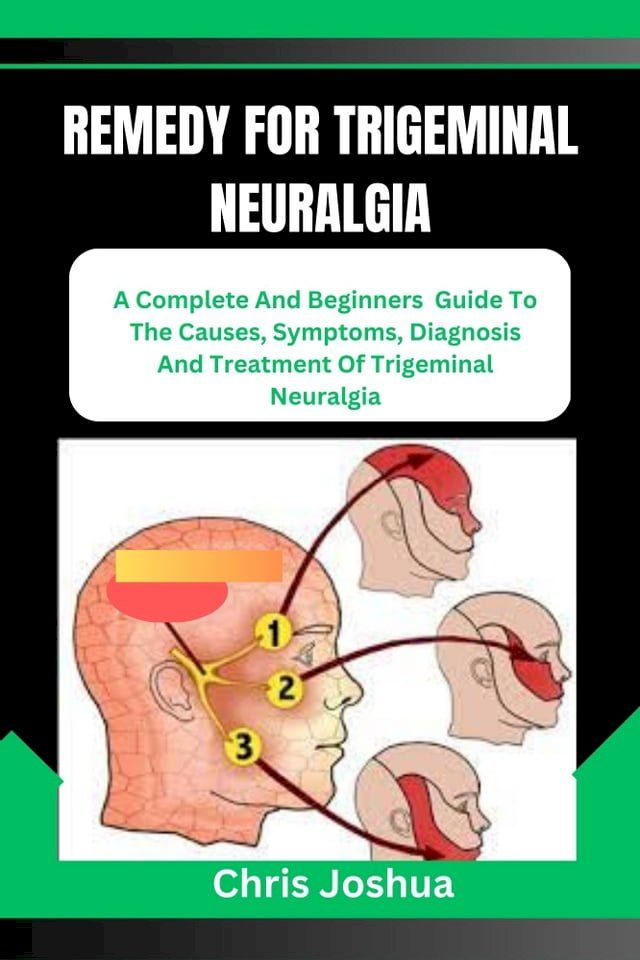  REMEDY FOR TRIGEMINAL NEURALGIA(Kobo/電子書)