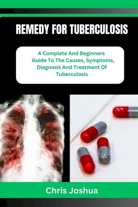 REMEDY FOR TUBERCULOSIS(Kobo/電子書)