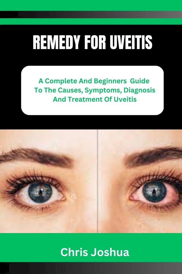  REMEDY FOR UVEITIS(Kobo/電子書)