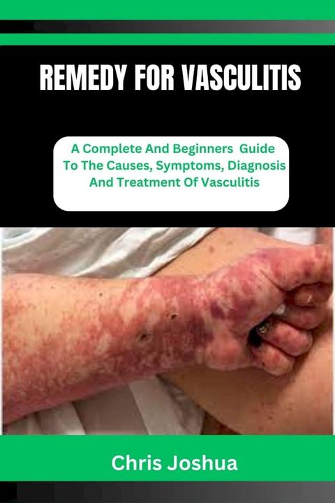 REMEDY FOR VASCULITIS(Kobo/電子書)