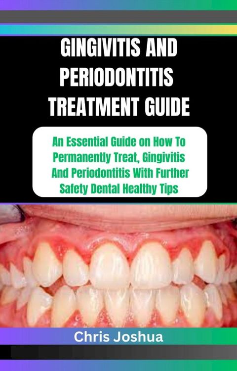 GINGIVITIS AND PERIODONTITIS TREATMENT GUIDE(Kobo/電子書)