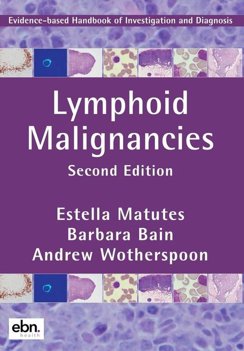 Lymphoid Malignancies(Kobo/電子書)