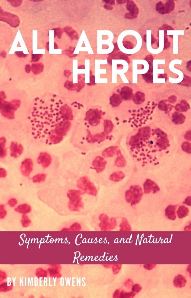  ALL ABOUT HERPES(Kobo/電子書)