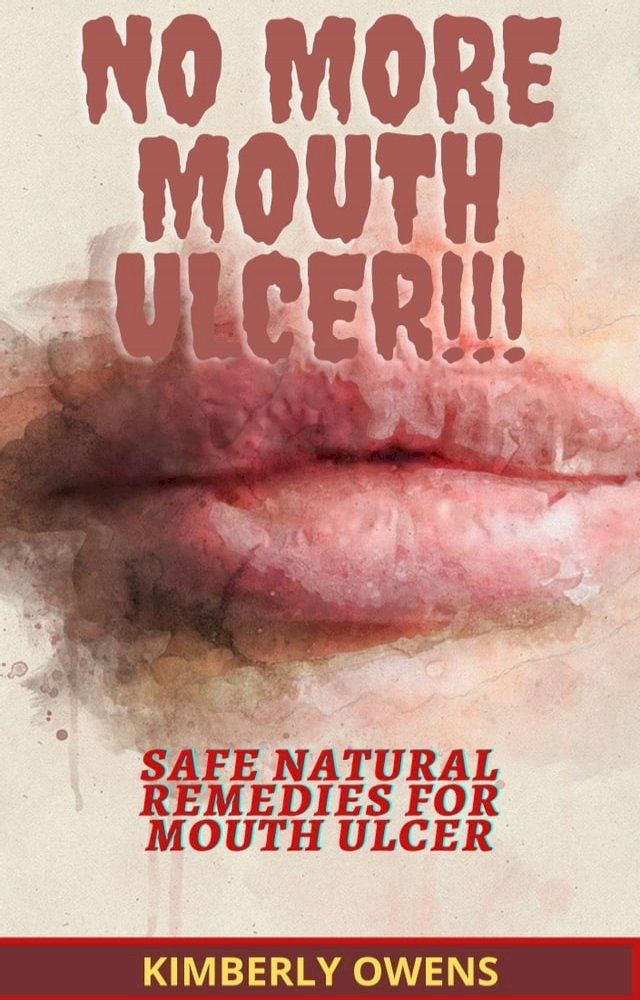  NO MORE MOUTH ULCERS(Kobo/電子書)