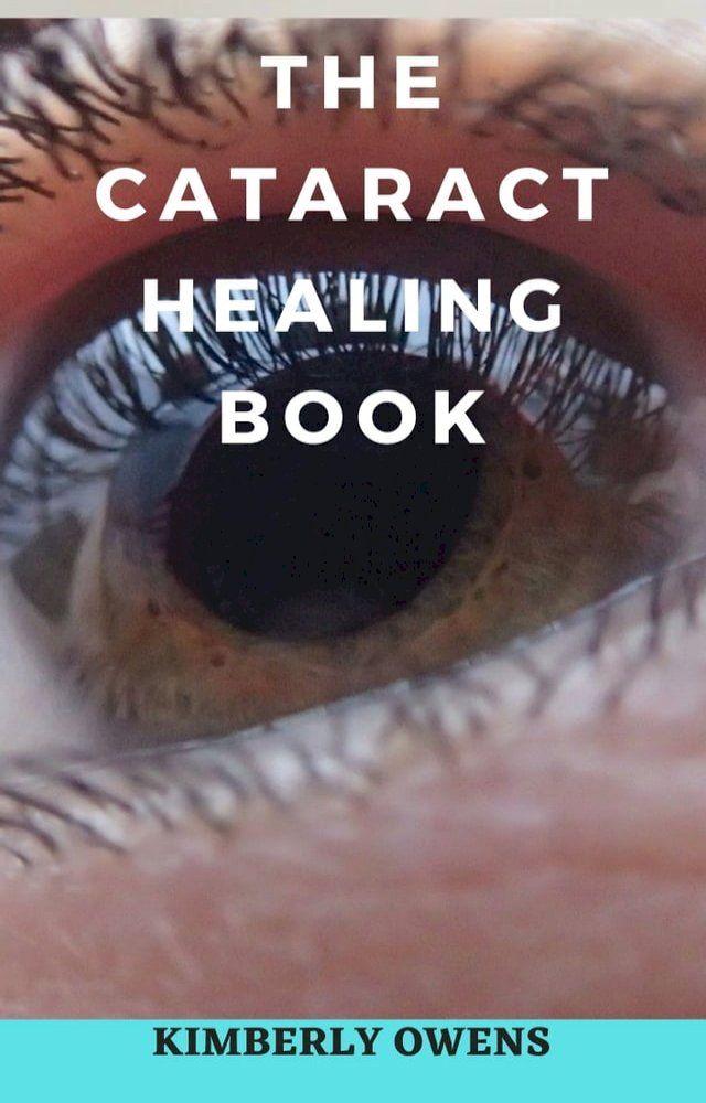  THE CATARACT HEALING BOOK(Kobo/電子書)